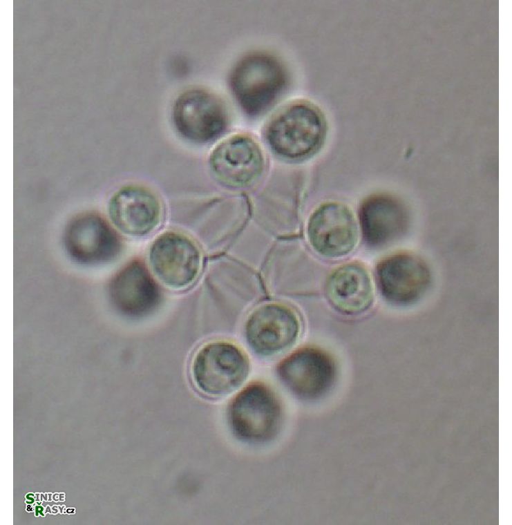Mucidosphaerium sphagnale