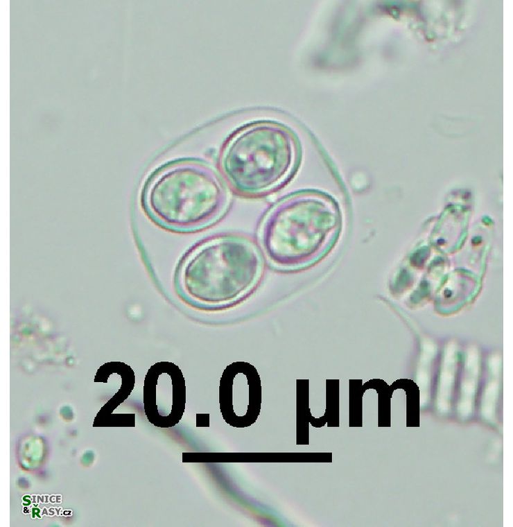 Oocystis marssonii