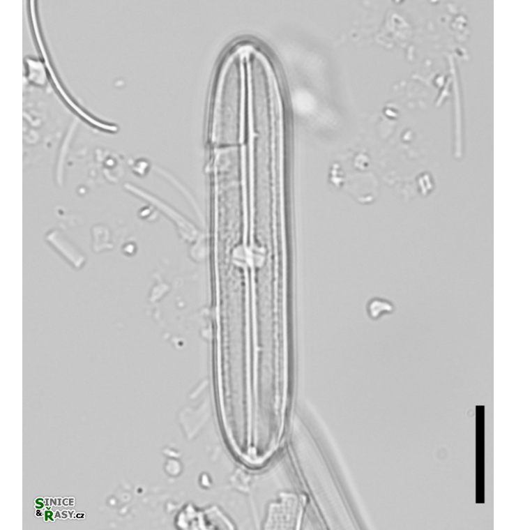 Neidium bisulcatum
