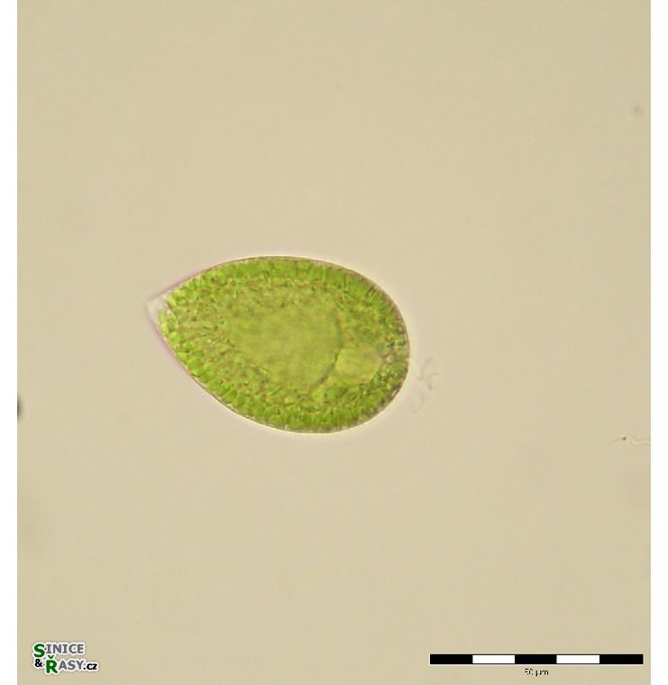 Gonyostomum semen 