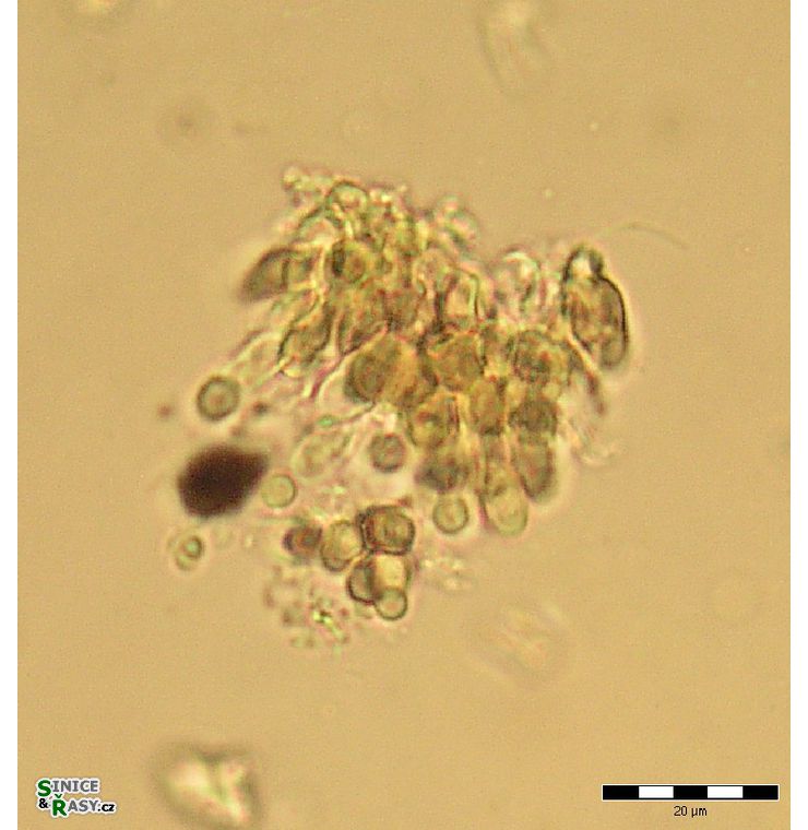 Chamaesiphon starmachii