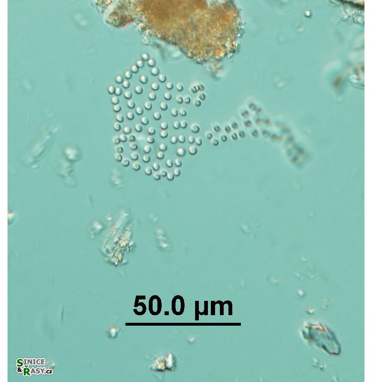 Coccopedia limnetica