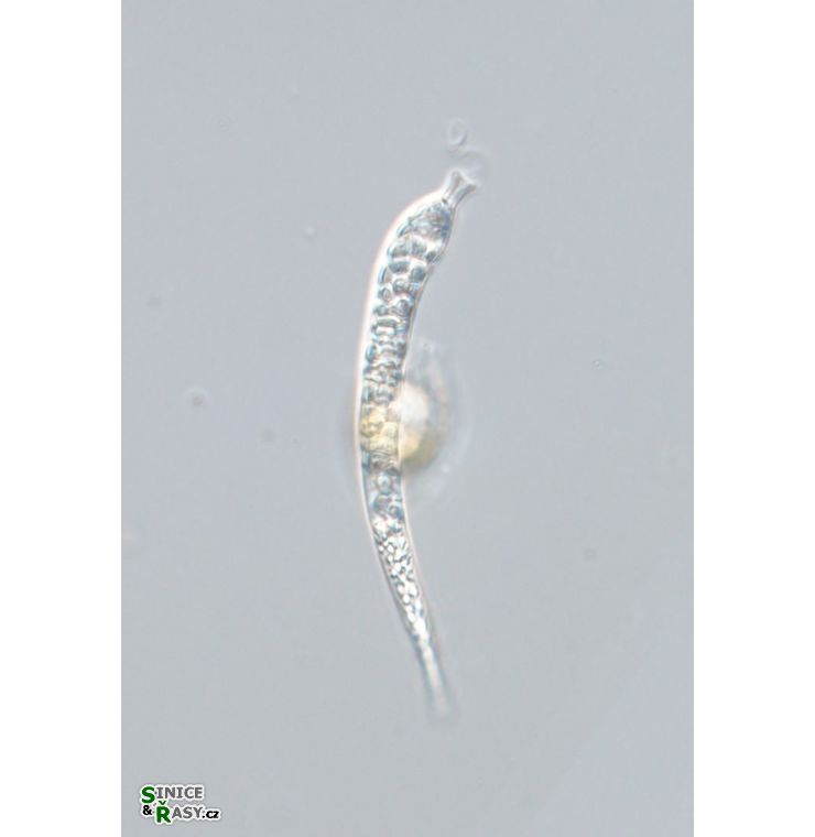 Astasia trotuosa