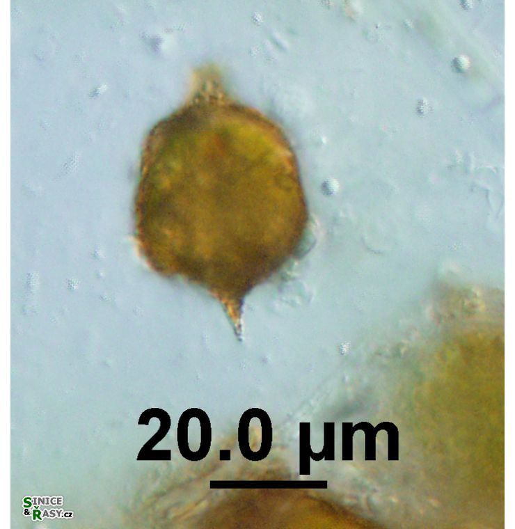 Strombomonas acuminata