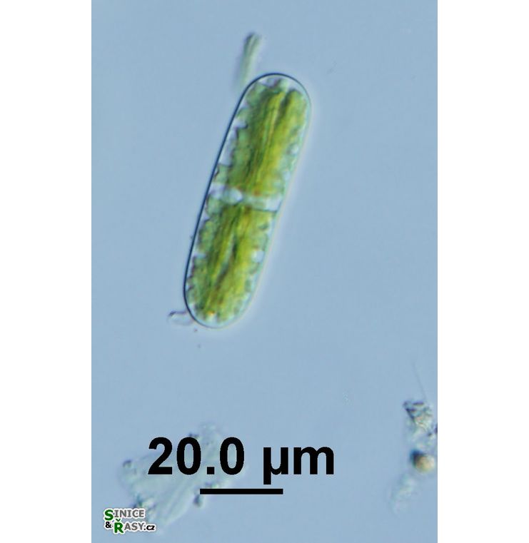 Cylindrocystis brebissoni
