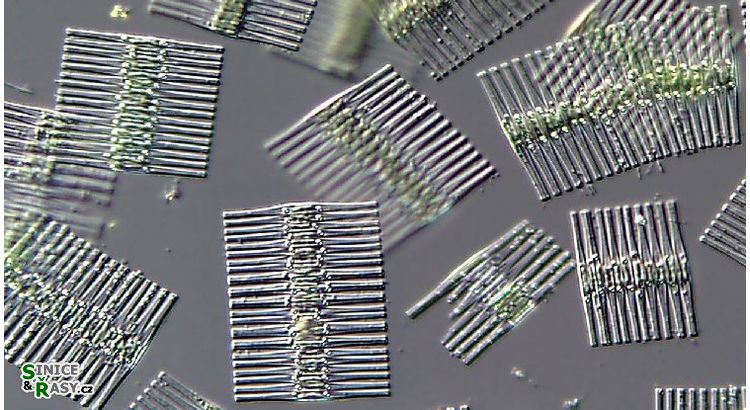 Fragilaria crotonensis