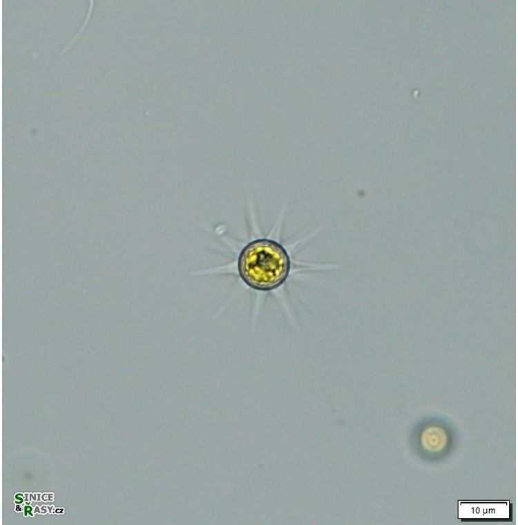 Echinosphaerella limnetica