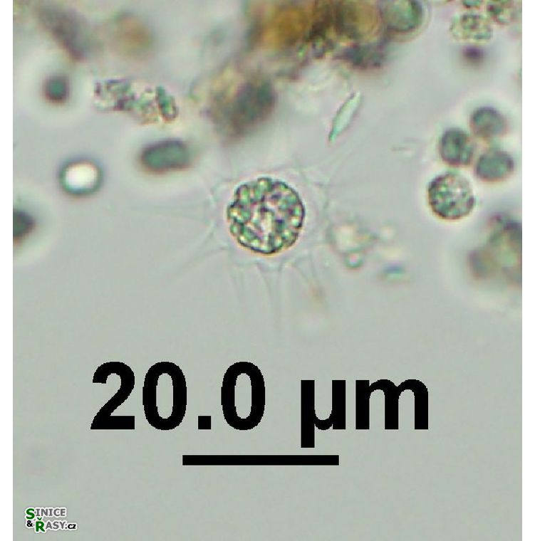 Echinosphaerella limnetica