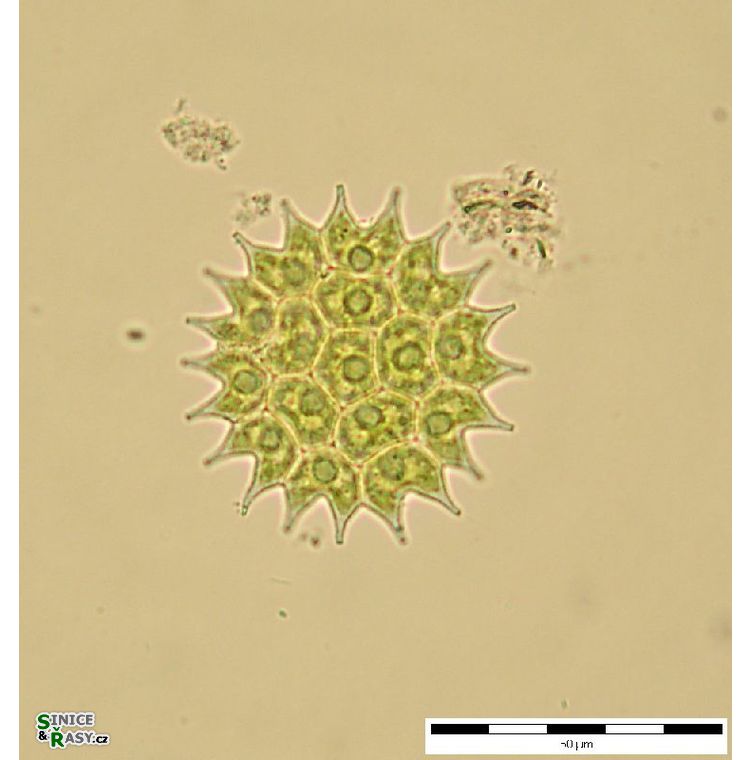 Pseudopediastrum boryanum