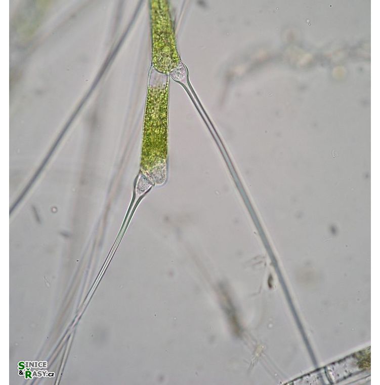 Bulbochaete