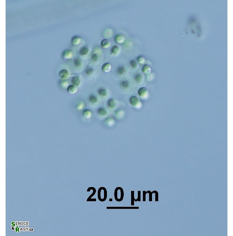 Mucidosphaerium pulchellum
