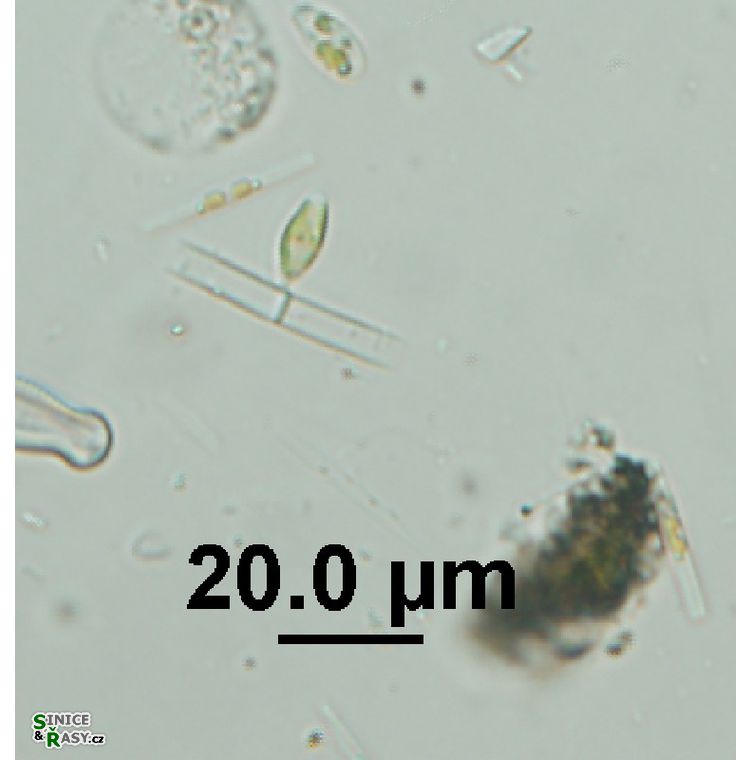 Epipyxis sp. 