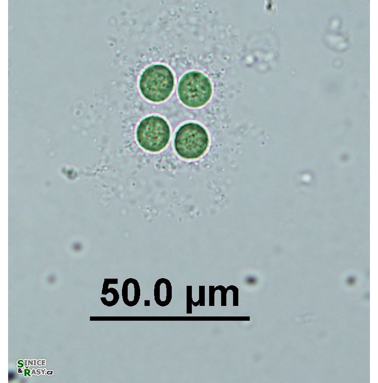 Limnococcus limneticus