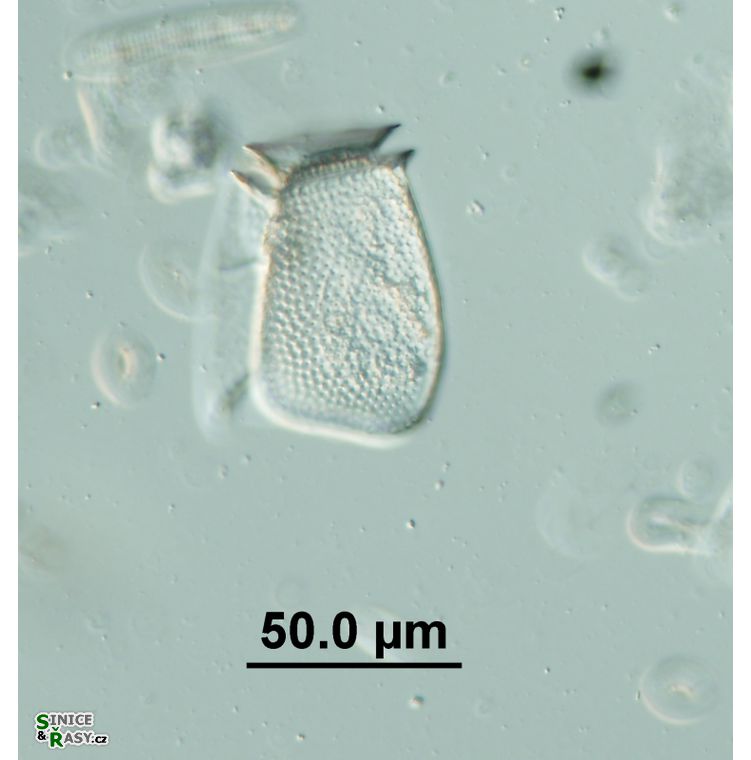 Dinophysis sp.