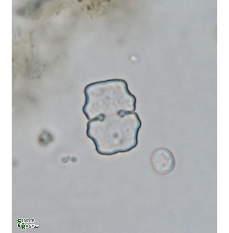 Cosmarium sphyrelatum