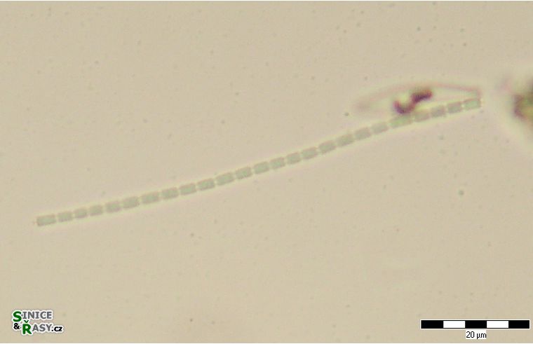 Pseudanabaena