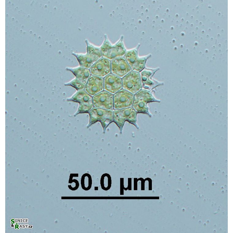 Pseudopediastrum boryanum