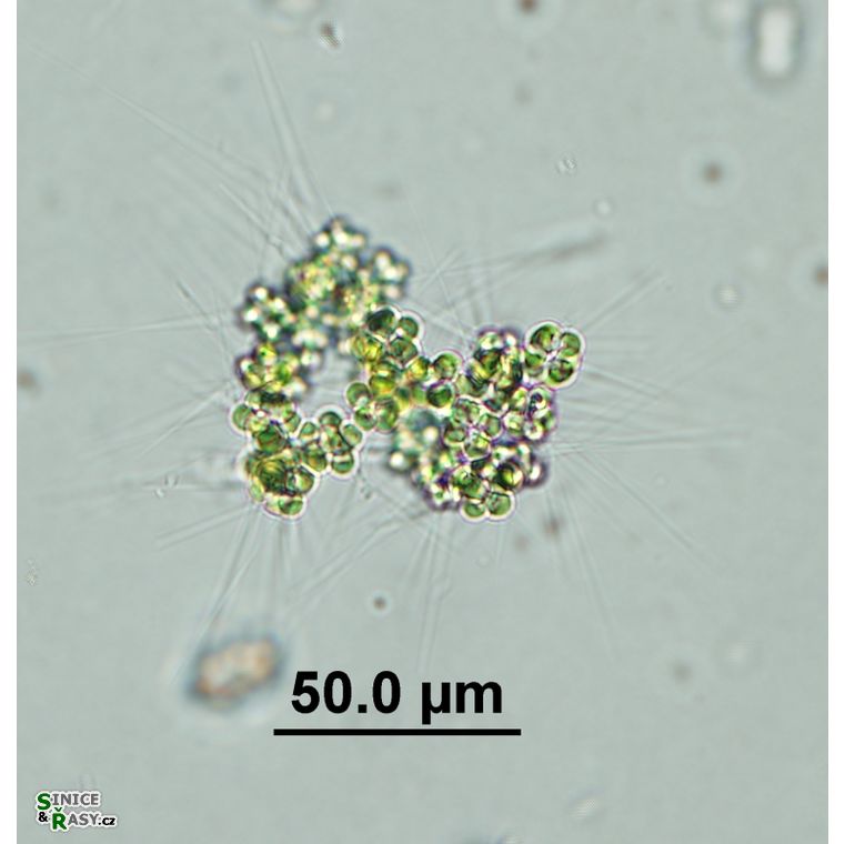 Micractinium borhnhemiense