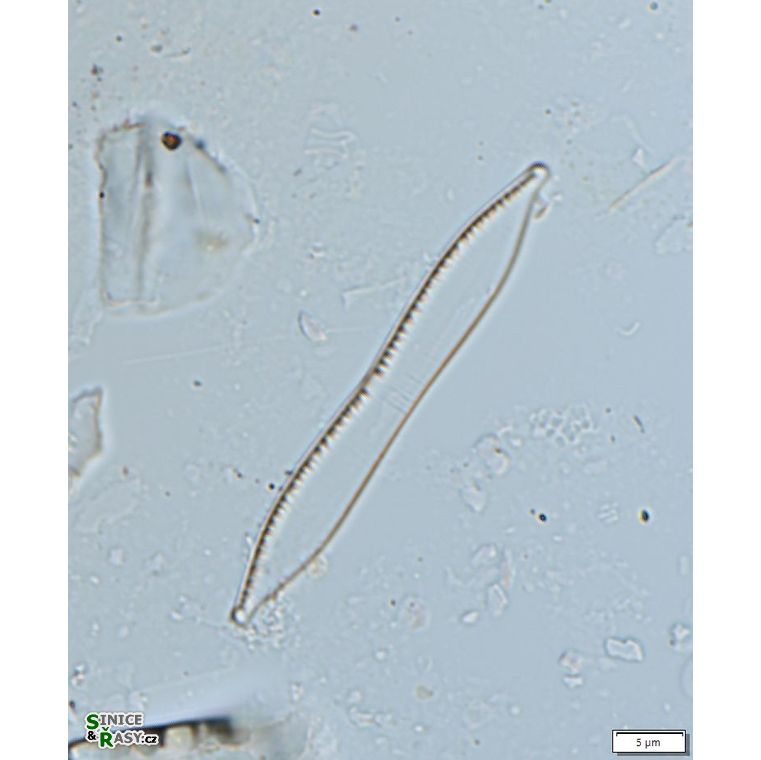 Nitzschia capitellata