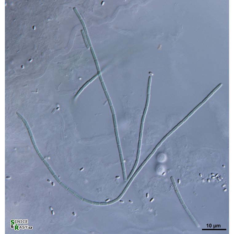 cf. Oculatella
