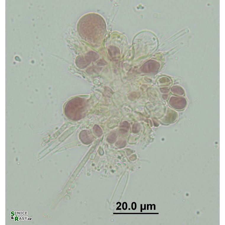 Chroococcopsis gigantea