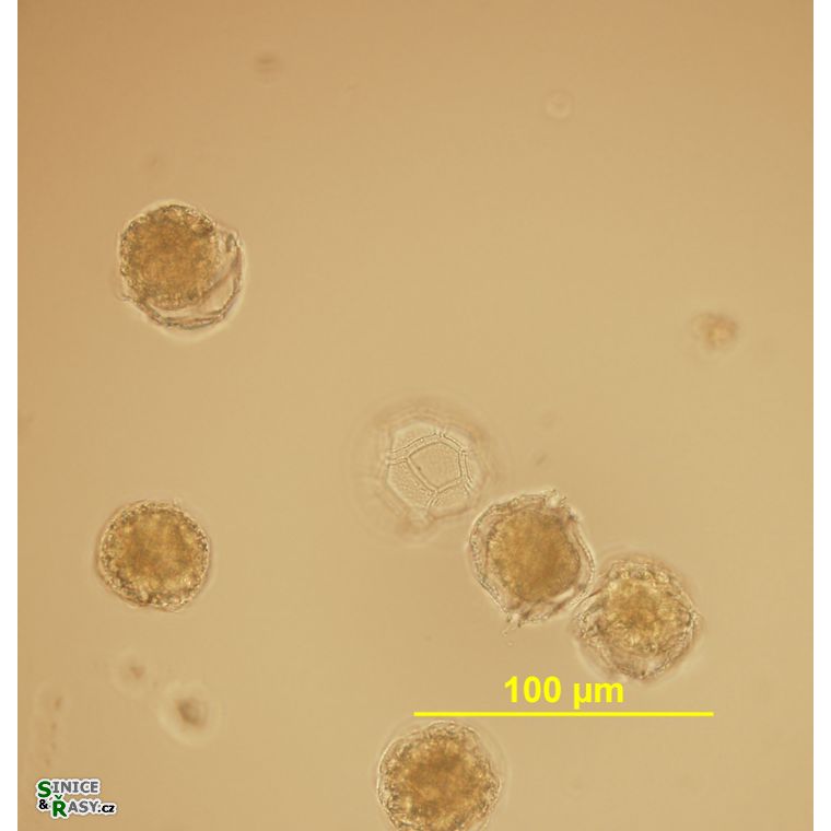 Peridinium gatunense