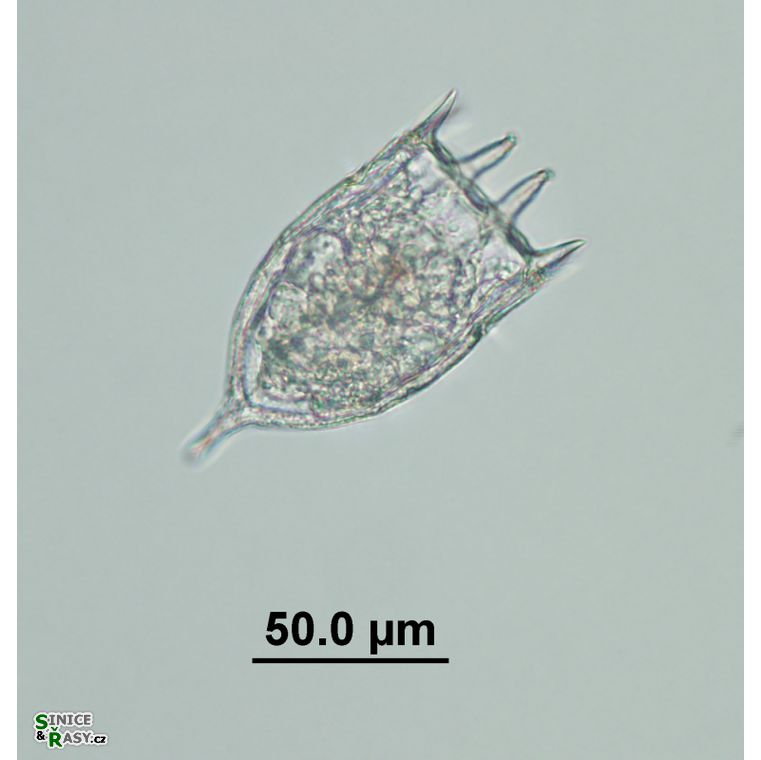 Keratella cochlearis
