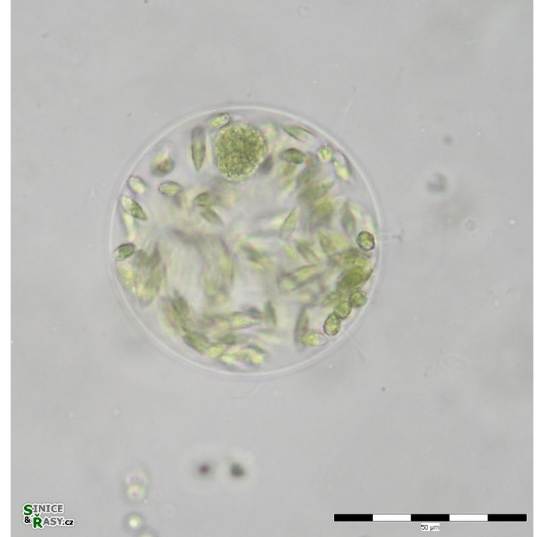 Stephanosphaera pluvialis