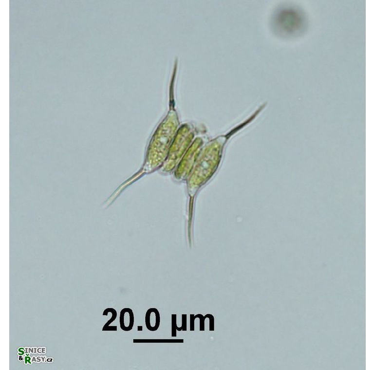 Desmodesmus protuberans