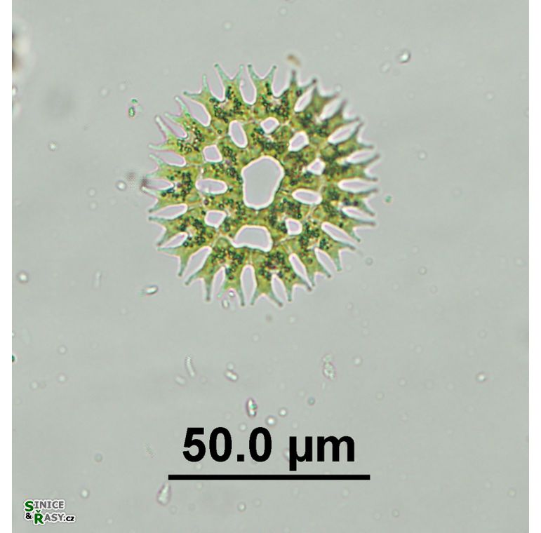 Parapediastrum biradiatum