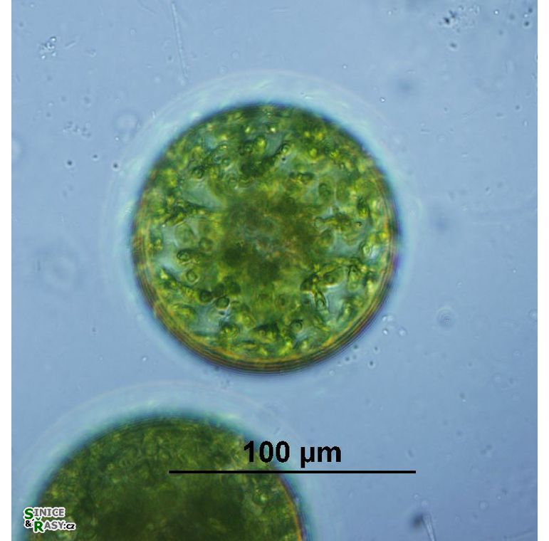 Eremosphaera viridis