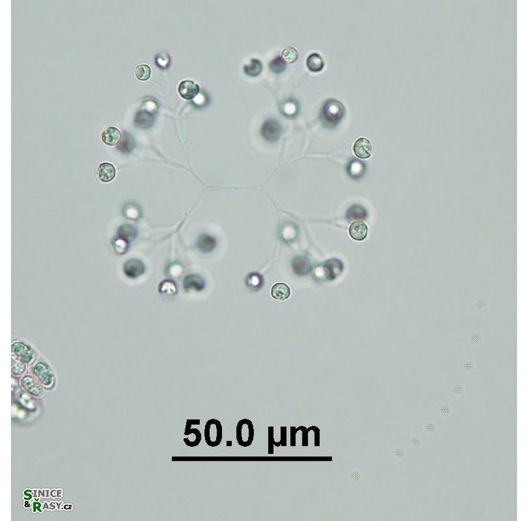 Mucidosphaerium cf. pulchellum
