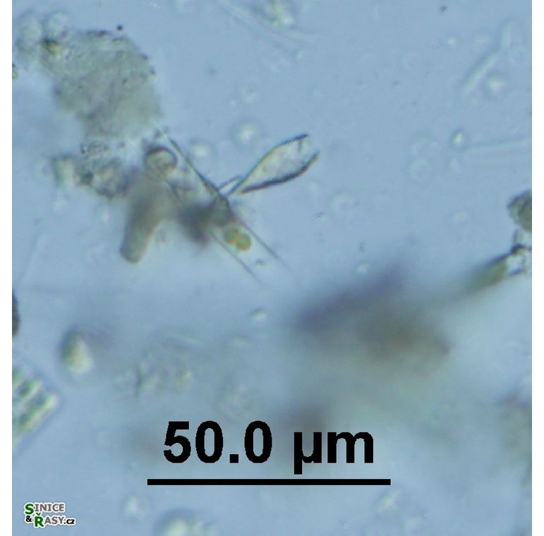 Epipyxis utriculus