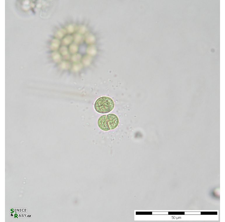 Chroococcus limneticus