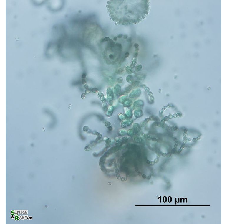 Dolichospermum lemmermannii