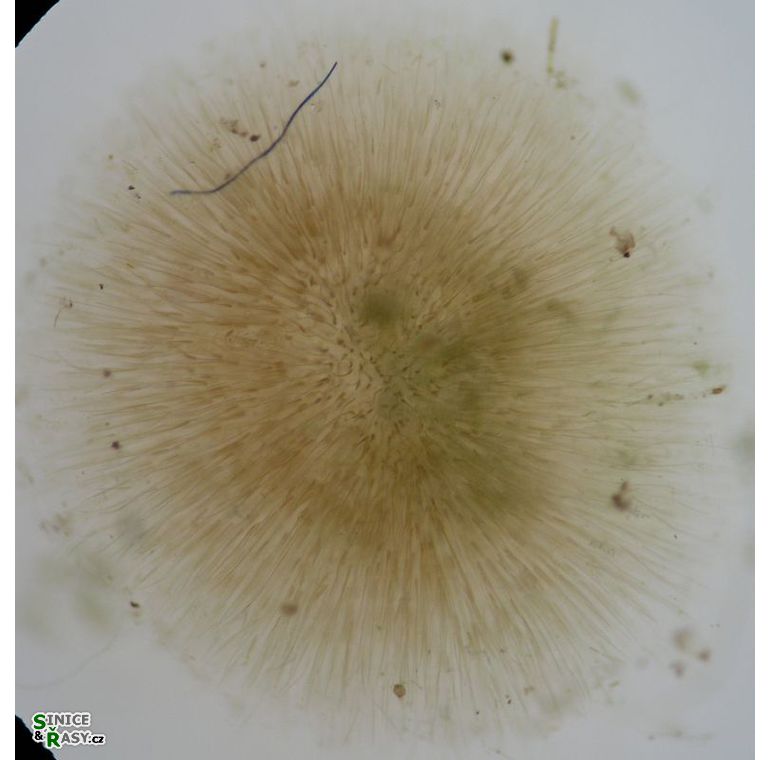 Gloeotrichia