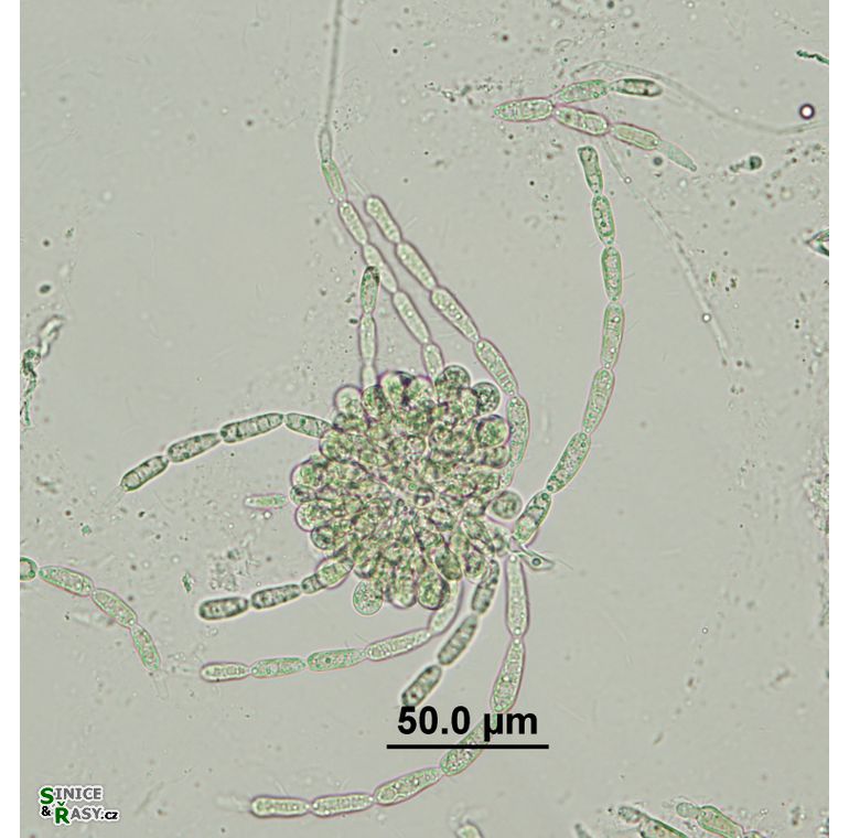Batrachospermum gelatinosum