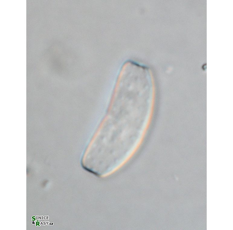 Actinotaenium infractum