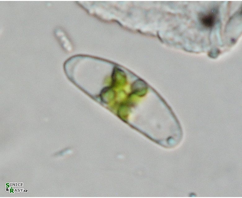 Closterium