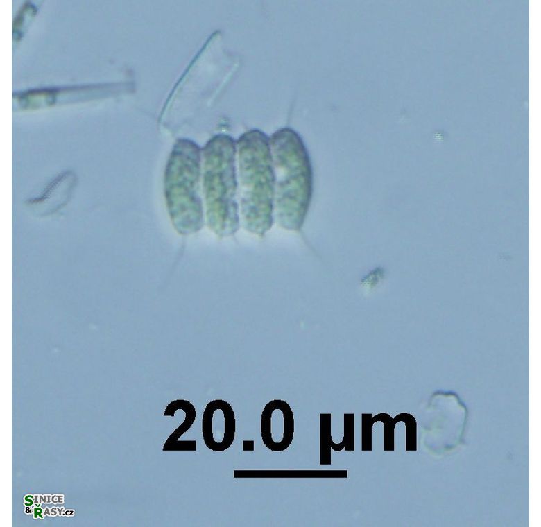 Desmodesmus cf. longispina