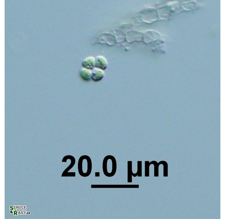 Tetrastrum staurogeniaeforme