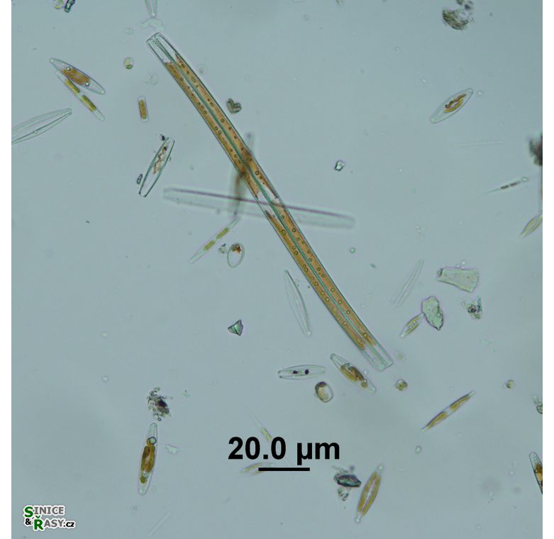 Nitzschia sigmoidea