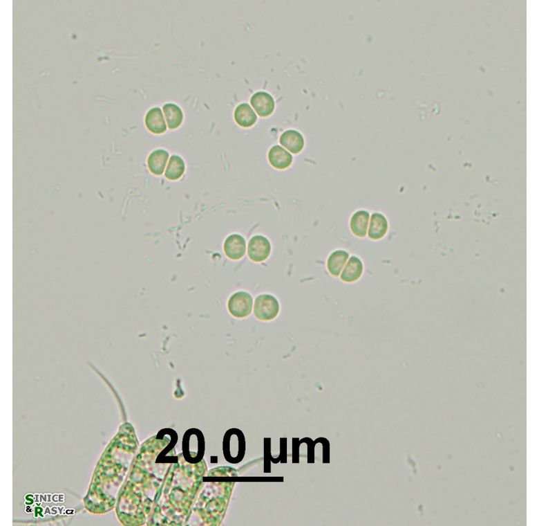 Chroococcus limneticus