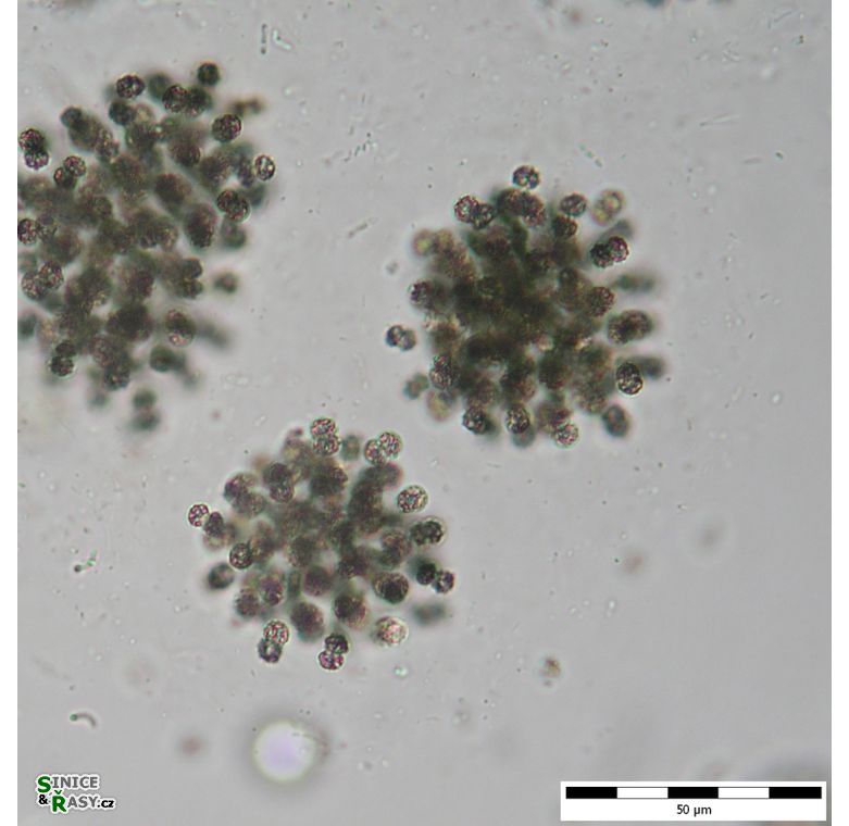 Radiocystis geminata
