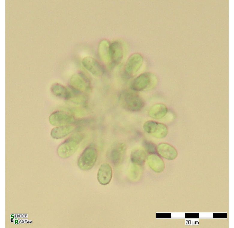 Woronichinia ruzickae