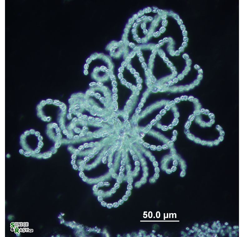 Dolichospermum lemmermannii