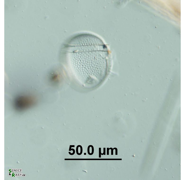 Phalacroma cf. rotundatum