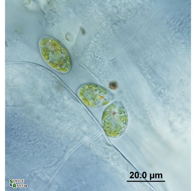Colacium cyclopicola