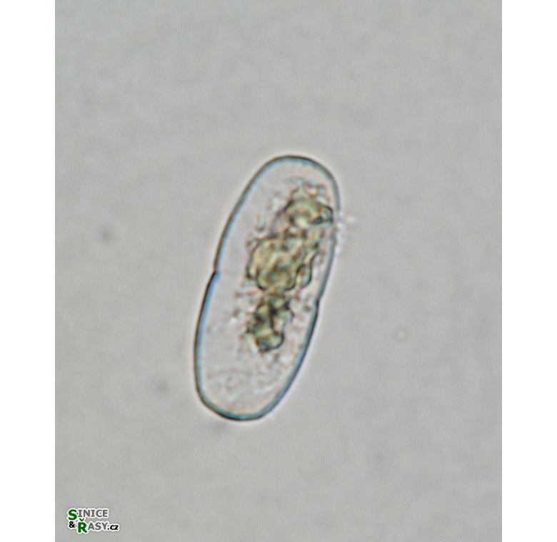 Actinotaenium kriegeri