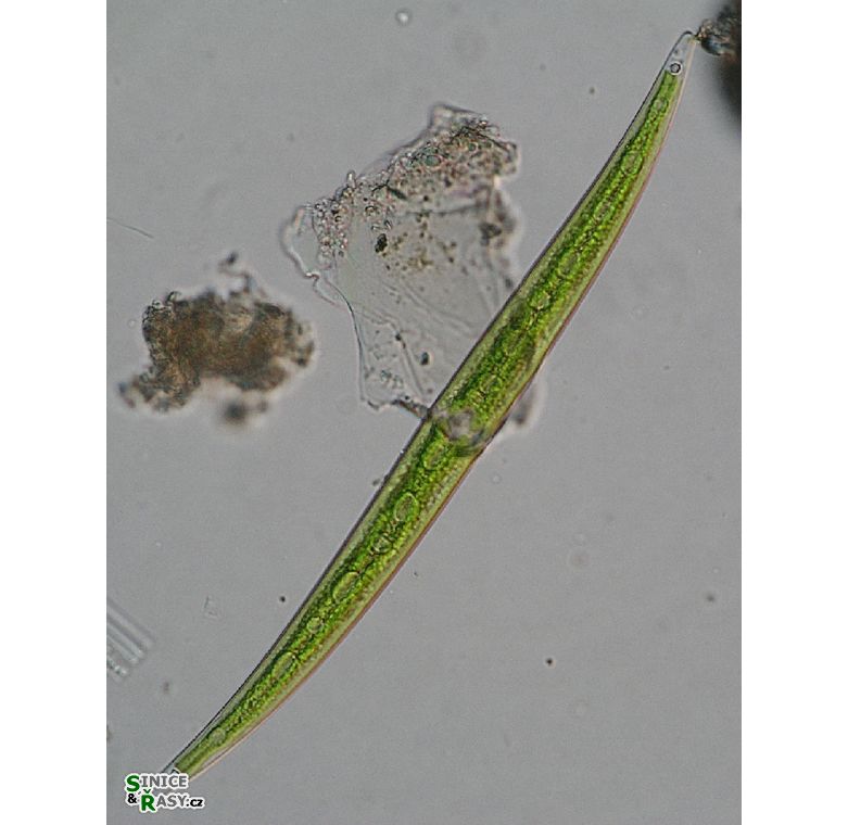 Closterium strigosum